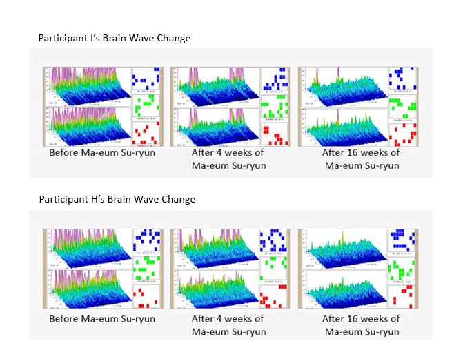 The Effects Of the Ma-eum Su-ryun Program On The Brain Function Of University Students